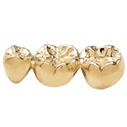 Стоматологическое золото