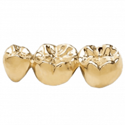 Стоматологическое золото